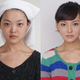 Image for article titled Intense Photos of Plastic Surgery Tranformations Going Viral in China